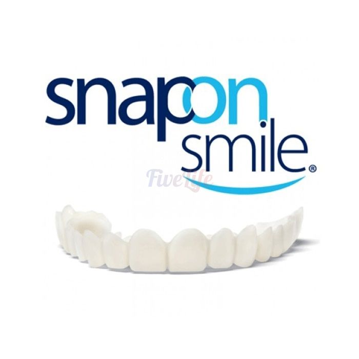 〘 Snap-On Smile 〙 〘 veneers 〙